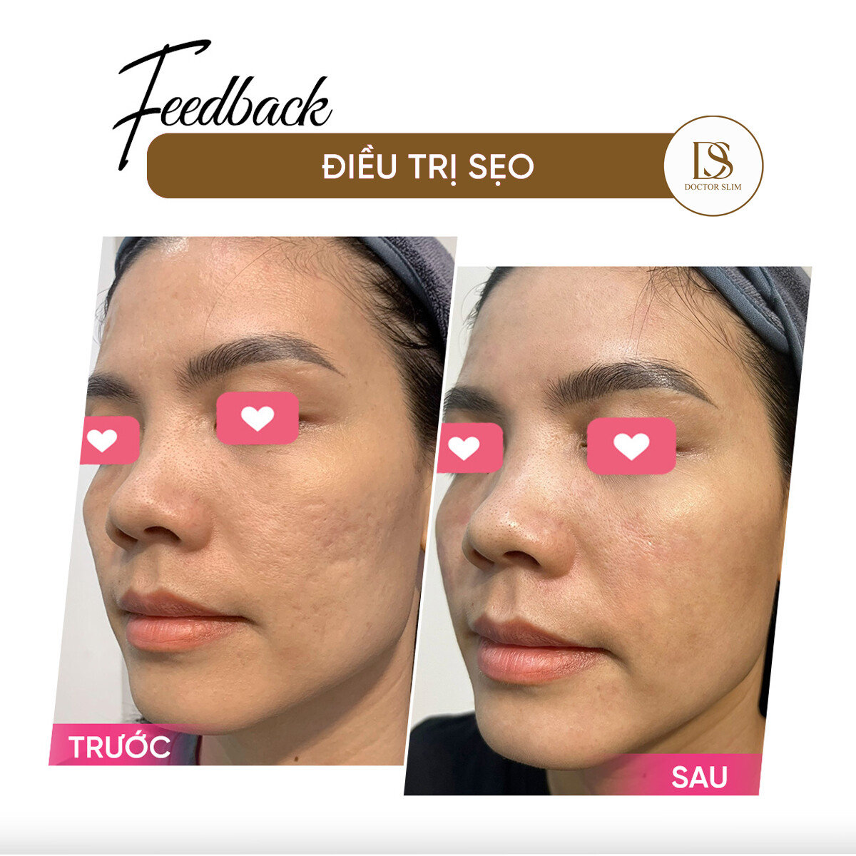 Phòng Khám Doctor Slim (AMC) 5