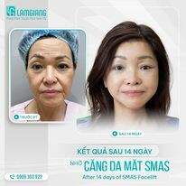 Phòng Khám Chuyên Khoa Thẩm Mỹ Lam Giang 12