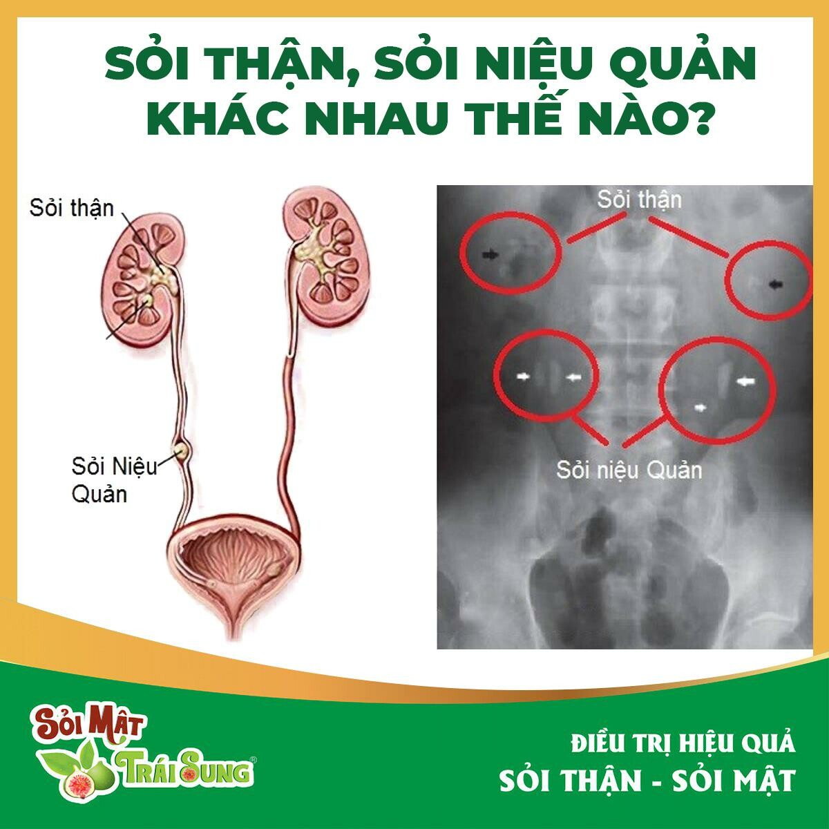 Dược Phẩm An Đông 5