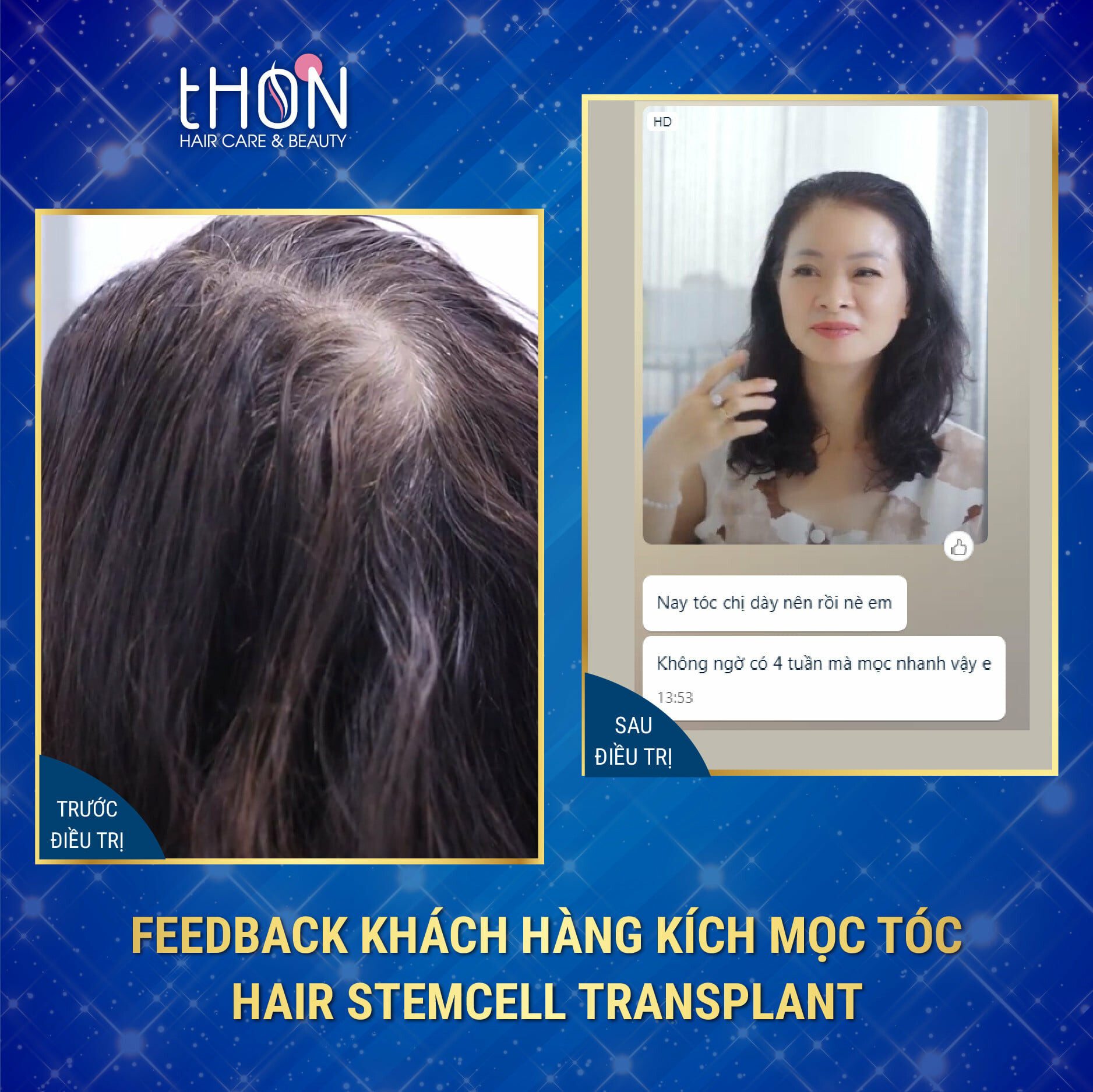 Thon Hair Care & Beauty 5