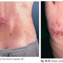 Chăm Sóc Sức Khỏe Vĩnh Đức 9