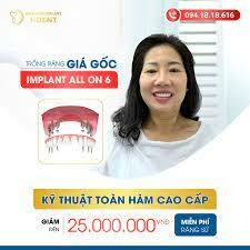 IMPLANT NHA KHOA I-DENT 5