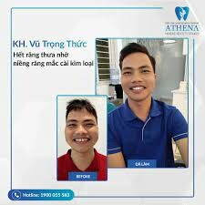 Thẩm Mỹ Athena 2