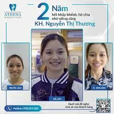 Thẩm Mỹ Athena 1