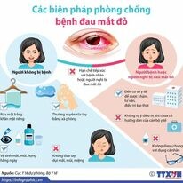 MẮT KÍNH MẮT SG 10