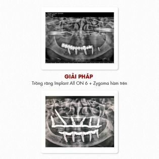 Nha khoa Đại Nam 8