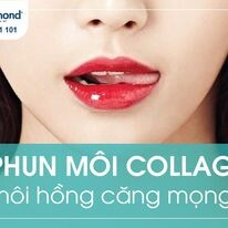 Thẩm Mỹ Viện Sky Diamond 4