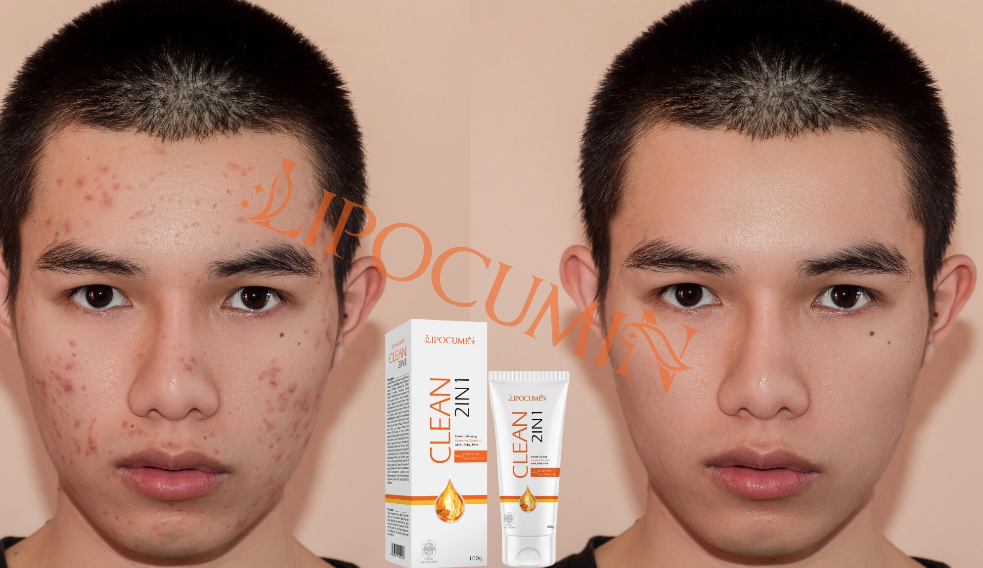 DƯỢC MỸ PHẨM LIPOCUMIN 1