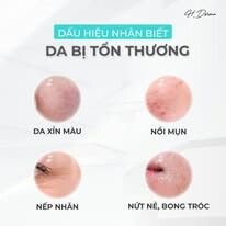 Dược Mỹ Phẩm H-Derma 3
