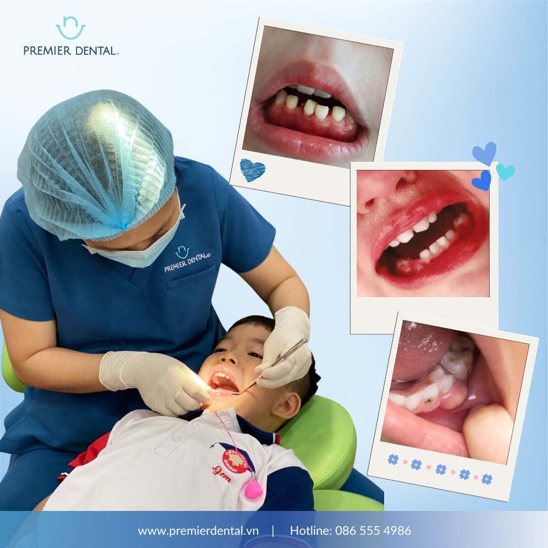 NHA VIỆT PREMIER DENTAL 12