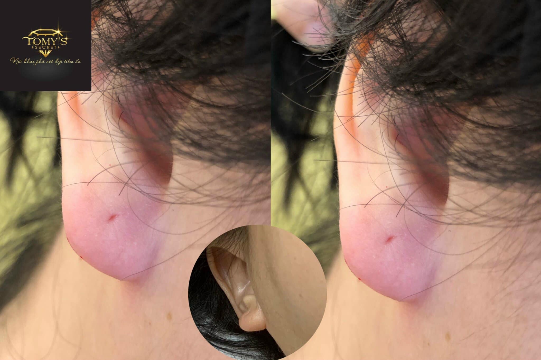 VIỆN THẨM MỸ CNC TOMY'S SECRET 8