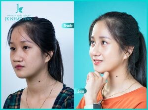 Bệnh viện Thẩm mỹ JK Nhật Hàn 8