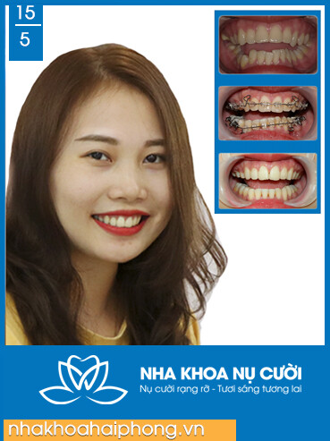 Nha Khoa Nụ Cười 8