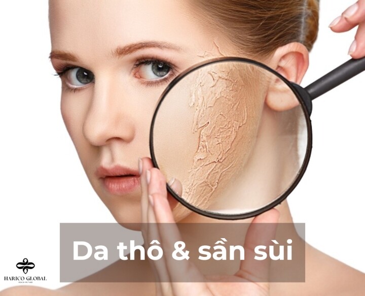 CÔNG TY TNHH HARICO GLOBAL 7