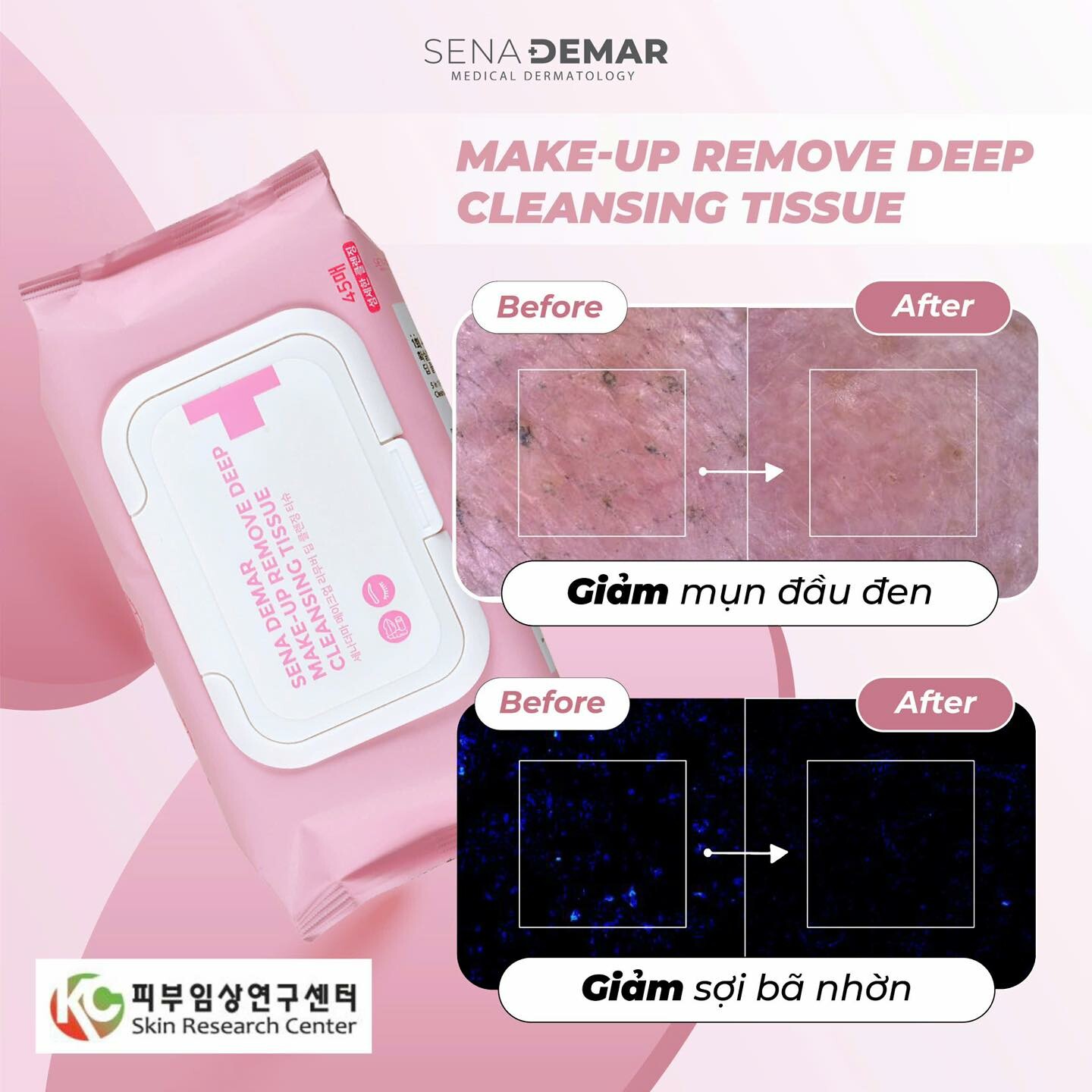 Xuất nhập khẩu Mỹ Phẩm Quốc Tế - Senademar 9