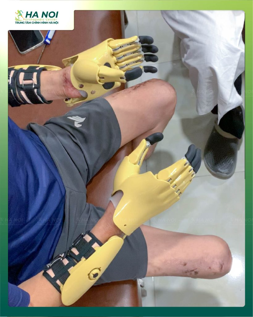 CHỈNH HÌNH HÀ NỘI 6