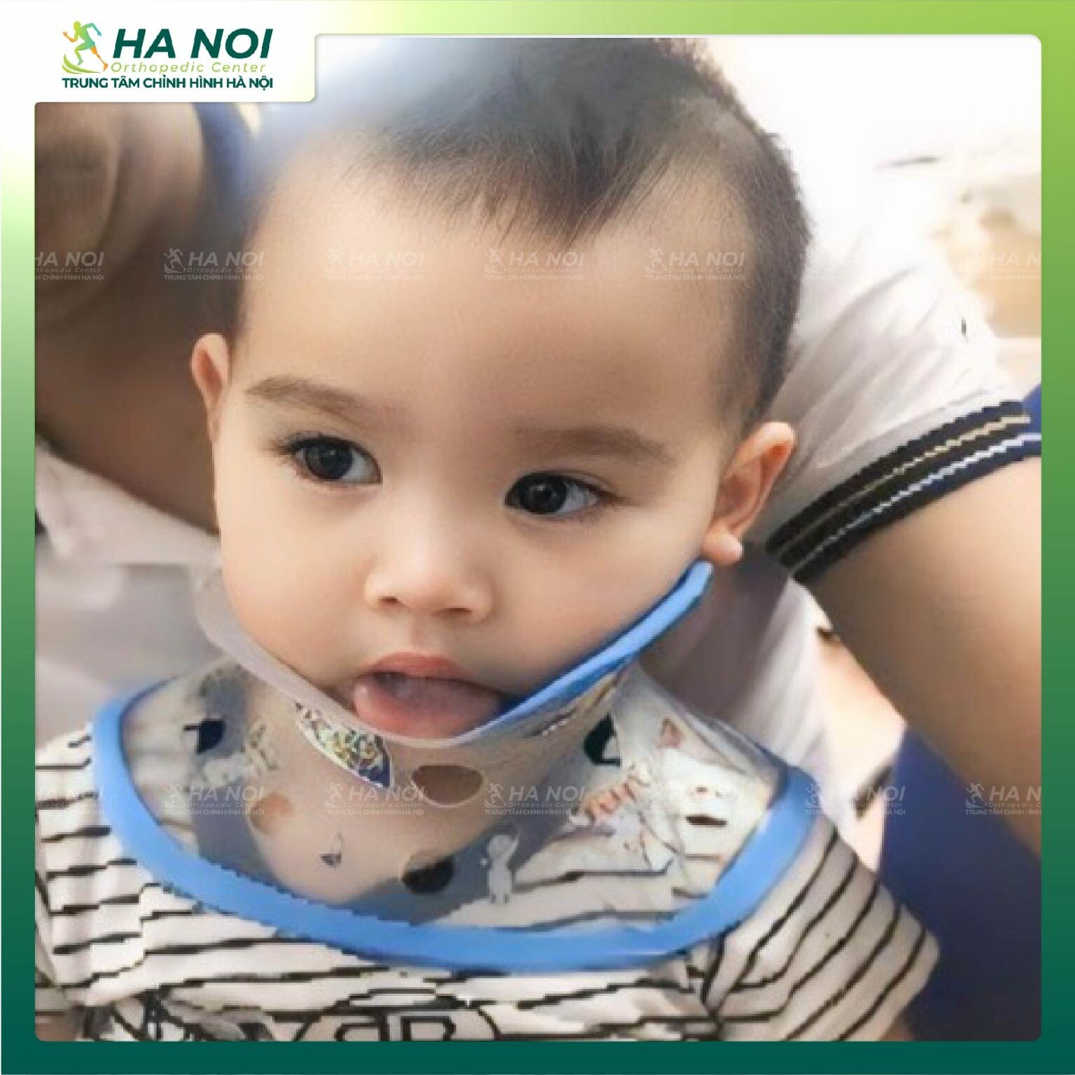 CHỈNH HÌNH HÀ NỘI 1