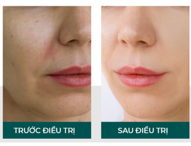 Esme Quá Đẹp Việt Nam - Vita Clinic 10