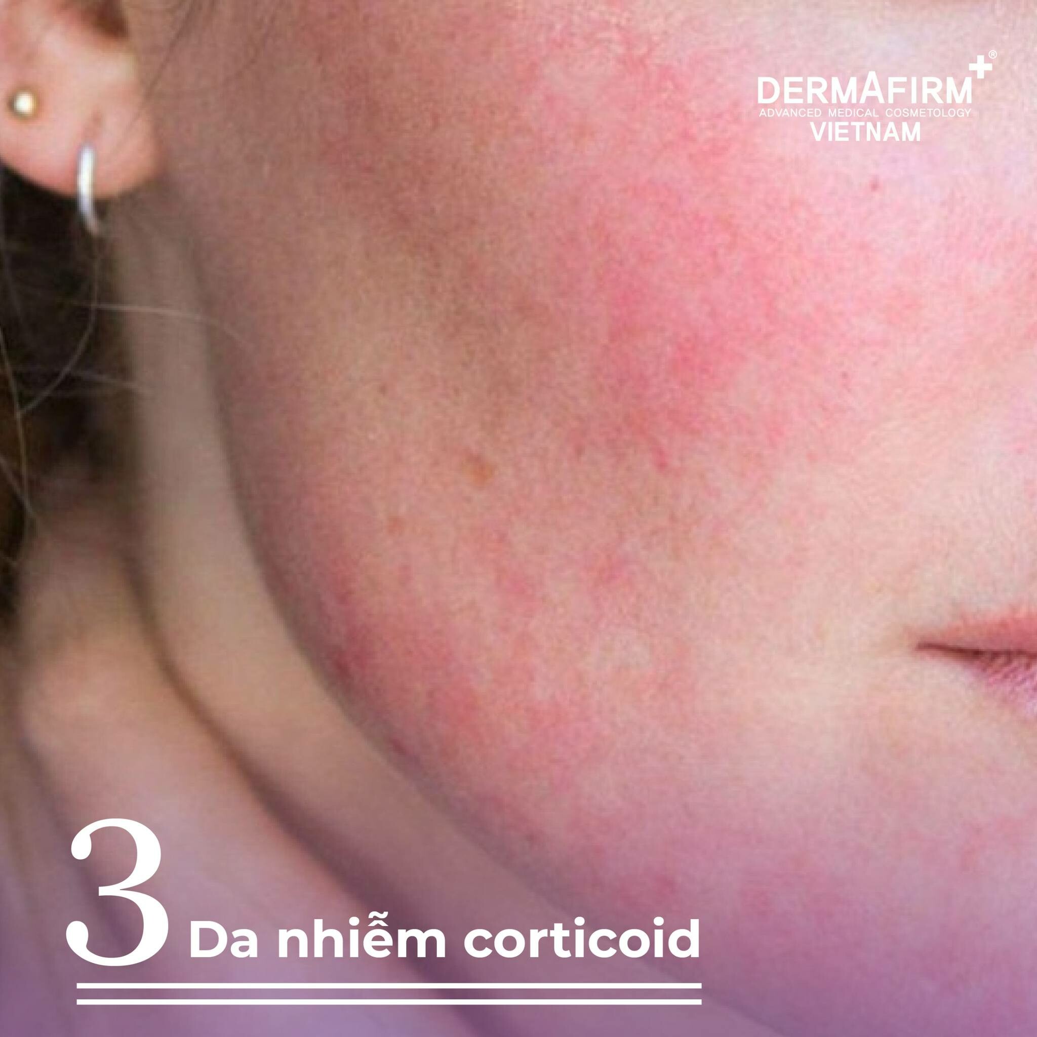 Labo de dermafirm Việt Nam 3