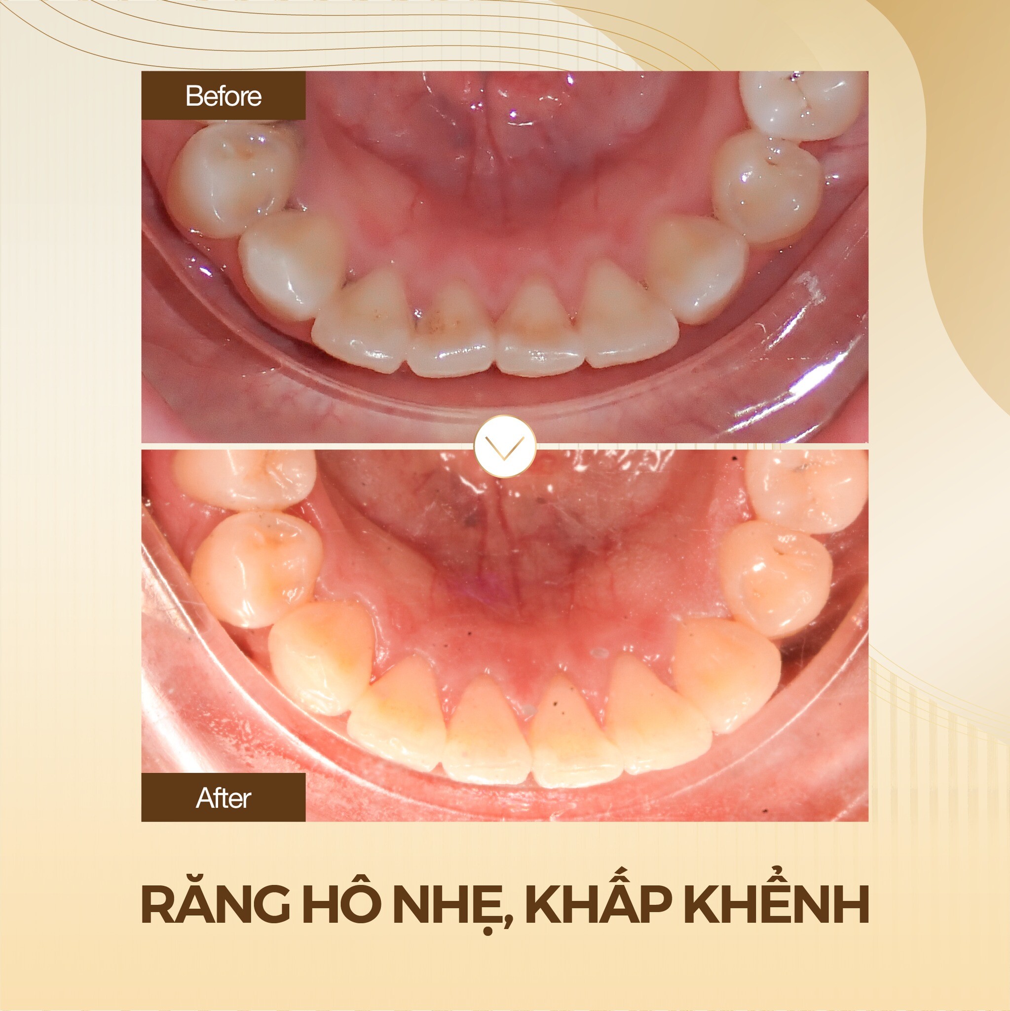 Chăm Sóc Sức Khỏe Nụ Cười Trung Tâm 9