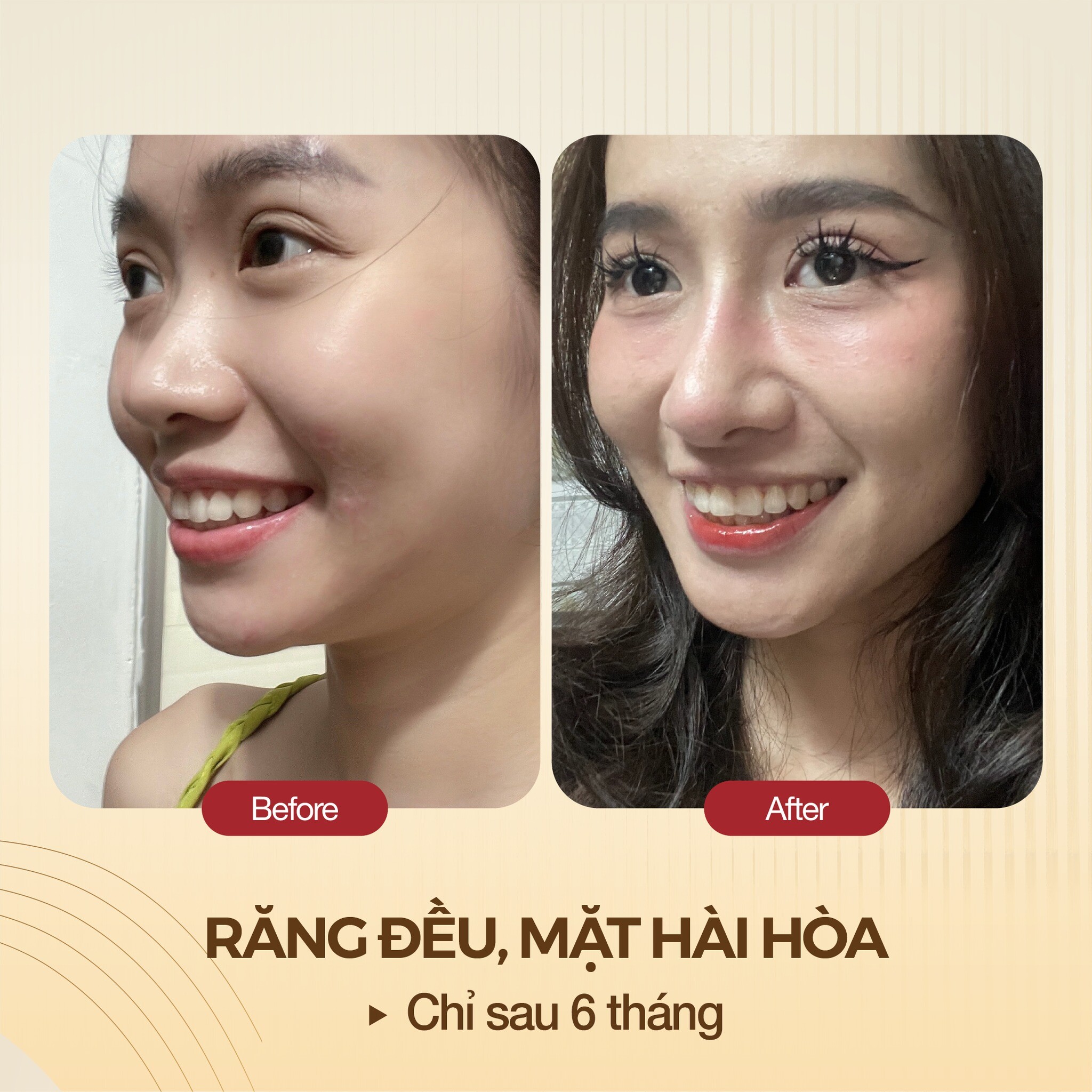 Chăm Sóc Sức Khỏe Nụ Cười Trung Tâm 7