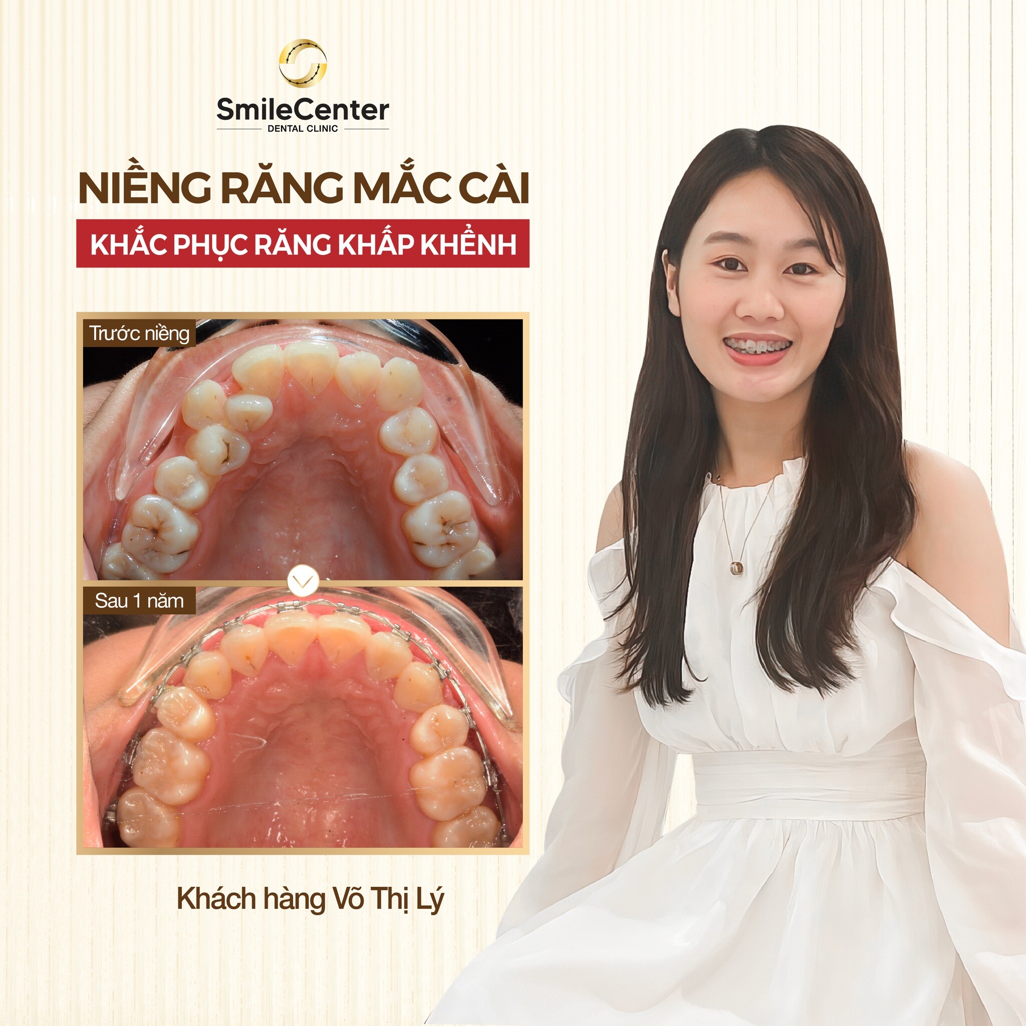 Chăm Sóc Sức Khỏe Nụ Cười Trung Tâm 11