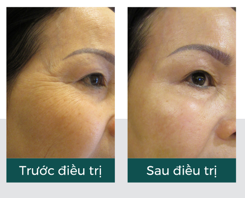 Esme Quá Đẹp Việt Nam - Vita Clinic 4