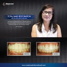 Westcoast International 6