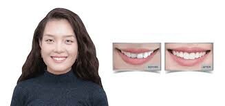 Westcoast International 2