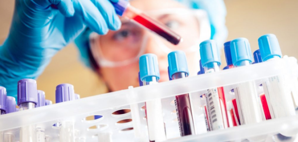 Top 8 dịch vụ xét nghiệm nước tiểu tại nhà nhanh chóng, chính xác